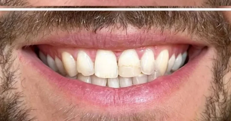 TEETH WHITENING POWDER CLAIMS TO ‘WHITEN IN WEEKS’